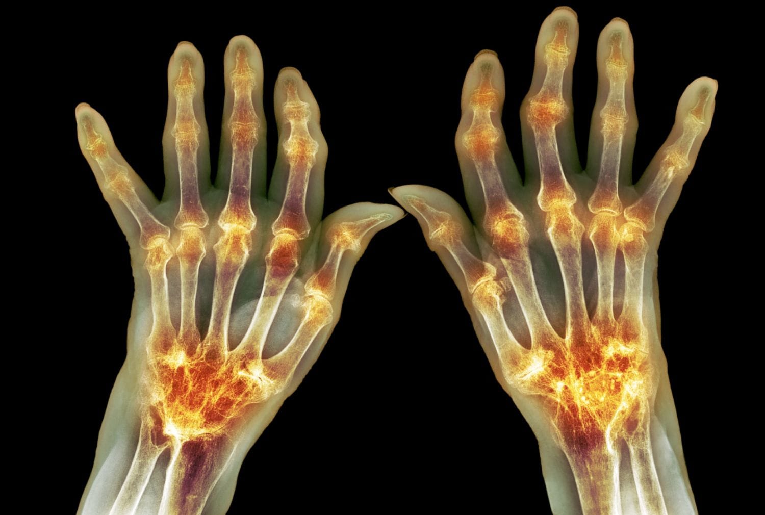 Фото: healthy-wealthy-nsp.com